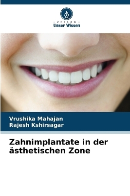 Zahnimplantate in der �sthetischen Zone - Vrushika Mahajan, Rajesh Kshirsagar