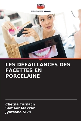 Les D�faillances Des Facettes En Porcelaine - Chetna Tarnach, Sameer Makkar, Jyotsana Sikri