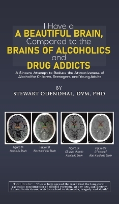 I Have a Beautiful Brain, Compared to the Brains of Alcoholics and Drug Addicts - DVM Odendhal  PhD  Stewart