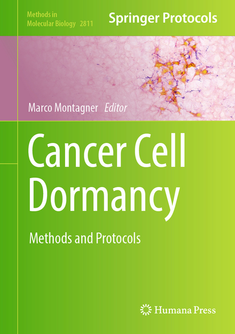 Cancer Cell Dormancy - 