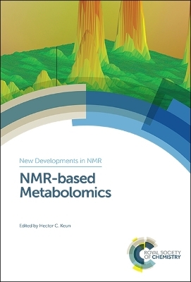 NMR-based Metabolomics - 