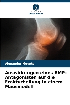 Auswirkungen eines BMP-Antagonisten auf die Frakturheilung in einem Mausmodell - Alexander Mounts