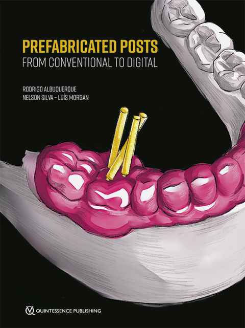 Prefabricated Posts - Rodrigo Albuquerque, Nelson Silva, Luís Morgan