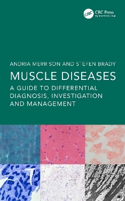 Muscle Diseases - 