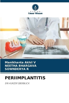 Periimplantitis - Manikhanta Akhil V, NEETHA BHARGAVA, SOWNDERYA R