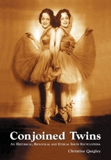 Conjoined Twins - Quigley, Christine