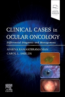 Clinical Cases in Ocular Oncology - 