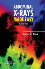 Abdominal X-Rays Made Easy - Begg, James D.