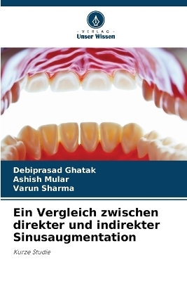 Ein Vergleich zwischen direkter und indirekter Sinusaugmentation - Debiprasad Ghatak, Ashish Mular, Varun Sharma