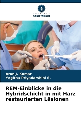 REM-Einblicke in die Hybridschicht in mit Harz restaurierten L�sionen - Arun J Kumar, Yogitha Priyadarshini S