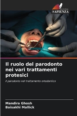 Il ruolo del parodonto nei vari trattamenti protesici - Mandira Ghosh, BAISAKHI MALLICK