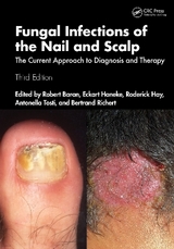 Fungal Infections of the Nail and Scalp - Baran, Robert; Haneke, Eckart; Hay, Roderick; Tosti, Antonella; Richert-Baran, Bertrand