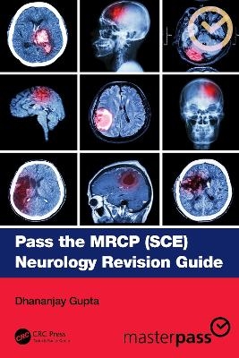 Pass the MRCP (SCE) Neurology Revision Guide - Dhananjay Gupta