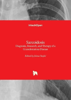 Sarcoidosis - 