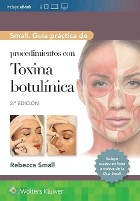 Small. Guía práctica de procedimientos con toxina botulínica - Rebecca Small