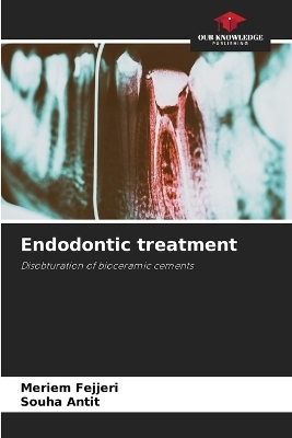 Endodontic treatment - Meriem Fejjeri, Souha Antit