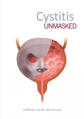 Cystitis Unmasked - 