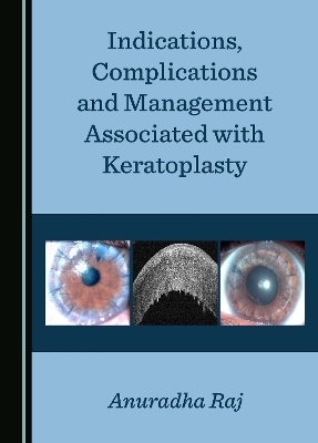 Indications, Complications and Management Associated with Keratoplasty - Anuradha Raj