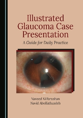 Illustrated Glaucoma Case Presentation - Naveed Nilforushan, Navid Abolfathzadeh