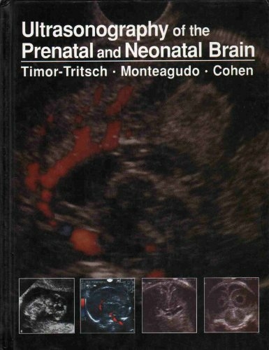 Ultrasonography of the Prenatal and Neonatal Brain - Ilan E. Timor-Tritsch, Ana Monteagudo, Harris L. Cohen