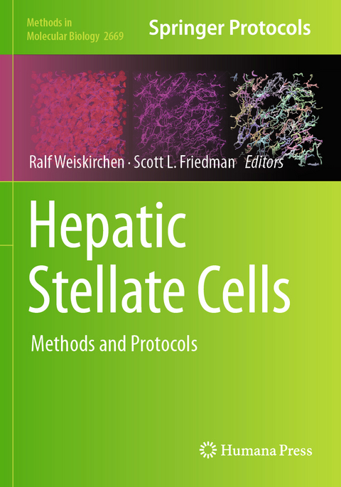 Hepatic Stellate Cells - 