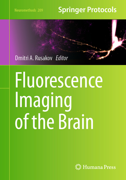 Fluorescence Imaging of the Brain - 