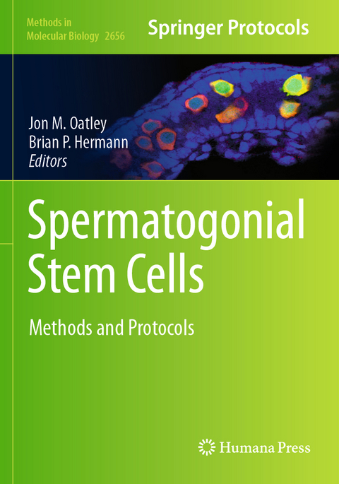 Spermatogonial Stem Cells - 