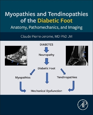 Myopathies and Tendinopathies of the Diabetic Foot - Claude Pierre-Jerome