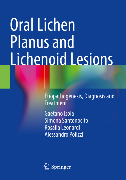 Oral Lichen Planus and Lichenoid Lesions - Gaetano Isola, Simona Santonocito, Rosalia Leonardi, Alessandro Polizzi