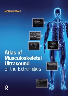 Atlas of Musculoskeletal Ultrasound of the Extremities - Mohini Rawat