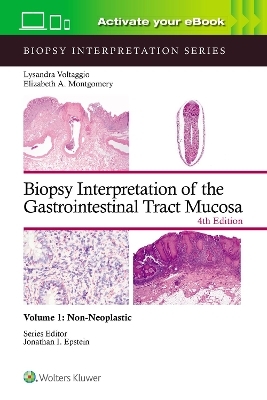 Biopsy Interpretation of the Gastrointestinal Tract Mucosa Volume 1 - Lysandra Voltaggio, ELIZABETH ANNE MONTGOMERY