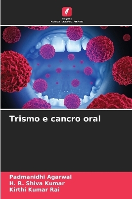 Trismo e cancro oral - Padmanidhi Agarwal, H R Shiva Kumar, Kirthi Kumar Rai