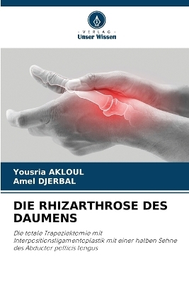 Die Rhizarthrose Des Daumens - Yousria AKLOUL, Amel DJERBAL