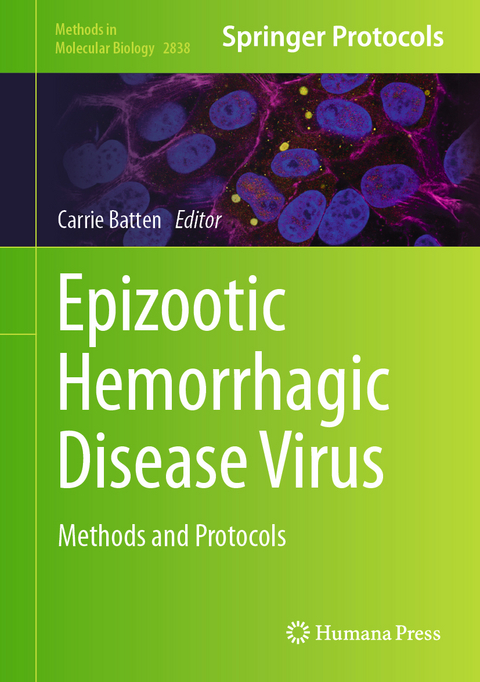 Epizootic Hemorrhagic Disease Virus - 