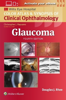 Glaucoma - Douglas J. Rhee