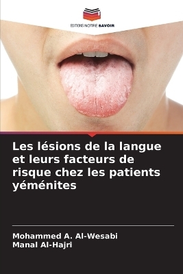 Les l�sions de la langue et leurs facteurs de risque chez les patients y�m�nites - Mohammed A Al-Wesabi, Manal Al-Hajri