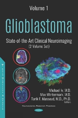 Glioblastoma - 