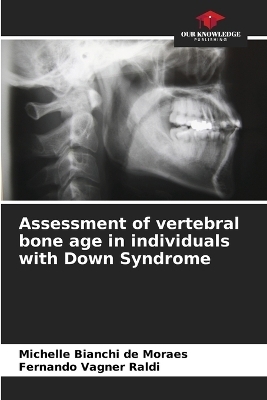 Assessment of vertebral bone age in individuals with Down Syndrome - Michelle Bianchi de Moraes, Fernando Vagner Raldi