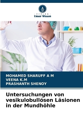 Untersuchungen von vesikulobull�sen L�sionen in der Mundh�hle - Mohamed Sharuff, Veena K M, Prashanth Shenoy