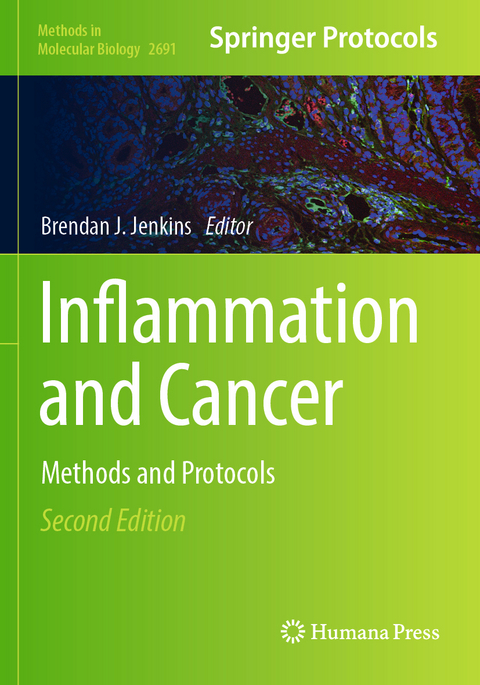 Inflammation and Cancer - 