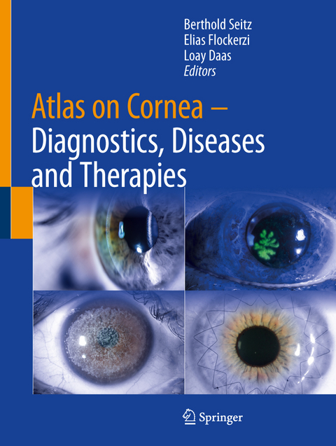 Atlas on Cornea - 