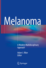 Melanoma - 