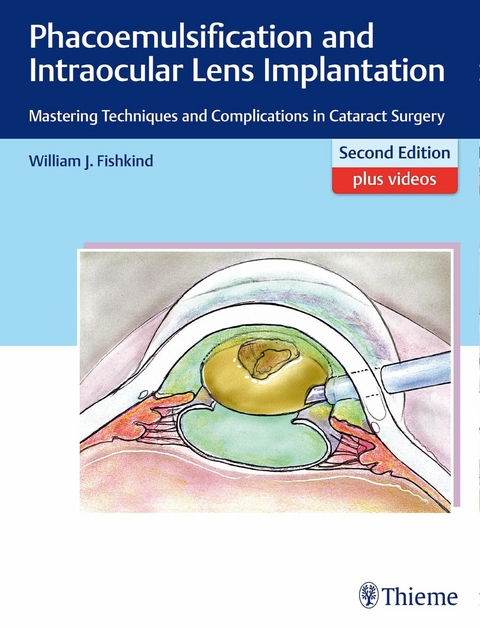 Phacoemulsification and Intraocular Lens Implantation -  William J. Fishkind