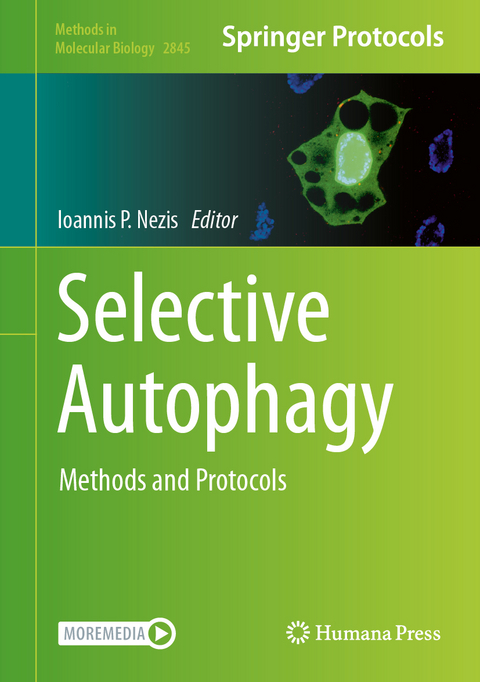 Selective Autophagy - 