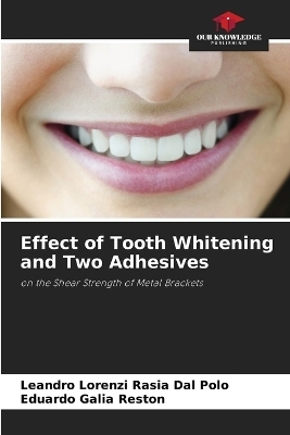 Effect of Tooth Whitening and Two Adhesives - Leandro Lorenzi Rasia Dal Polo, Eduardo Galia Reston