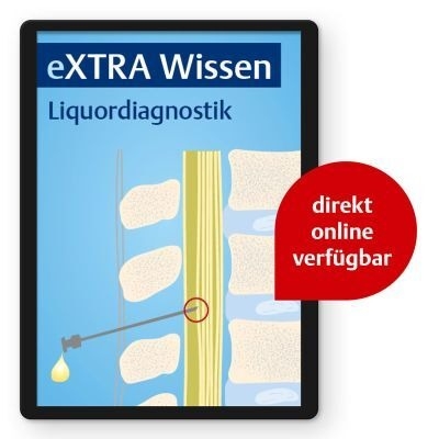 eXTRA Wissen - Liquordiagnostik