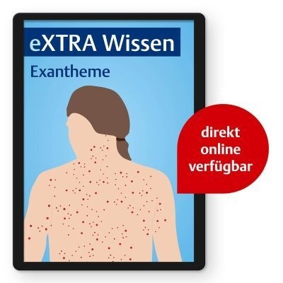 eXTRA Wissen - Exantheme