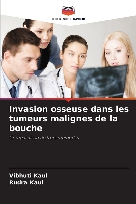 Invasion osseuse dans les tumeurs malignes de la bouche - Vibhuti Kaul, Rudra Kaul