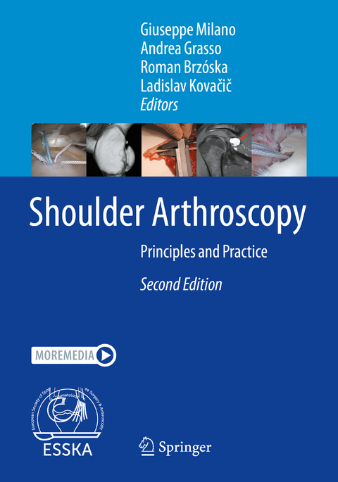 Shoulder Arthroscopy - 