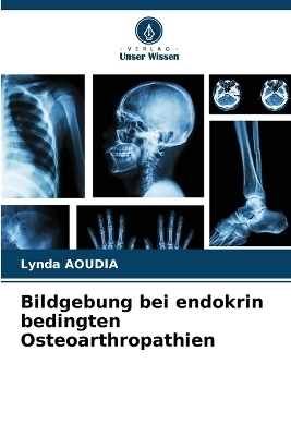 Bildgebung bei endokrin bedingten Osteoarthropathien - Lynda Aoudia